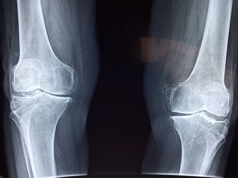 fizjoterapia kontuzje kolana